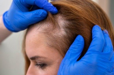 <p>Os nutrientes são absorvidos pelo corpo e chegam ao couro cabeludo via circulação.<br />
É assim que contribuem, de forma indireta, para fios mais fortes. Veja algumas sementes.</p>
 -  (crédito: Divulgação )