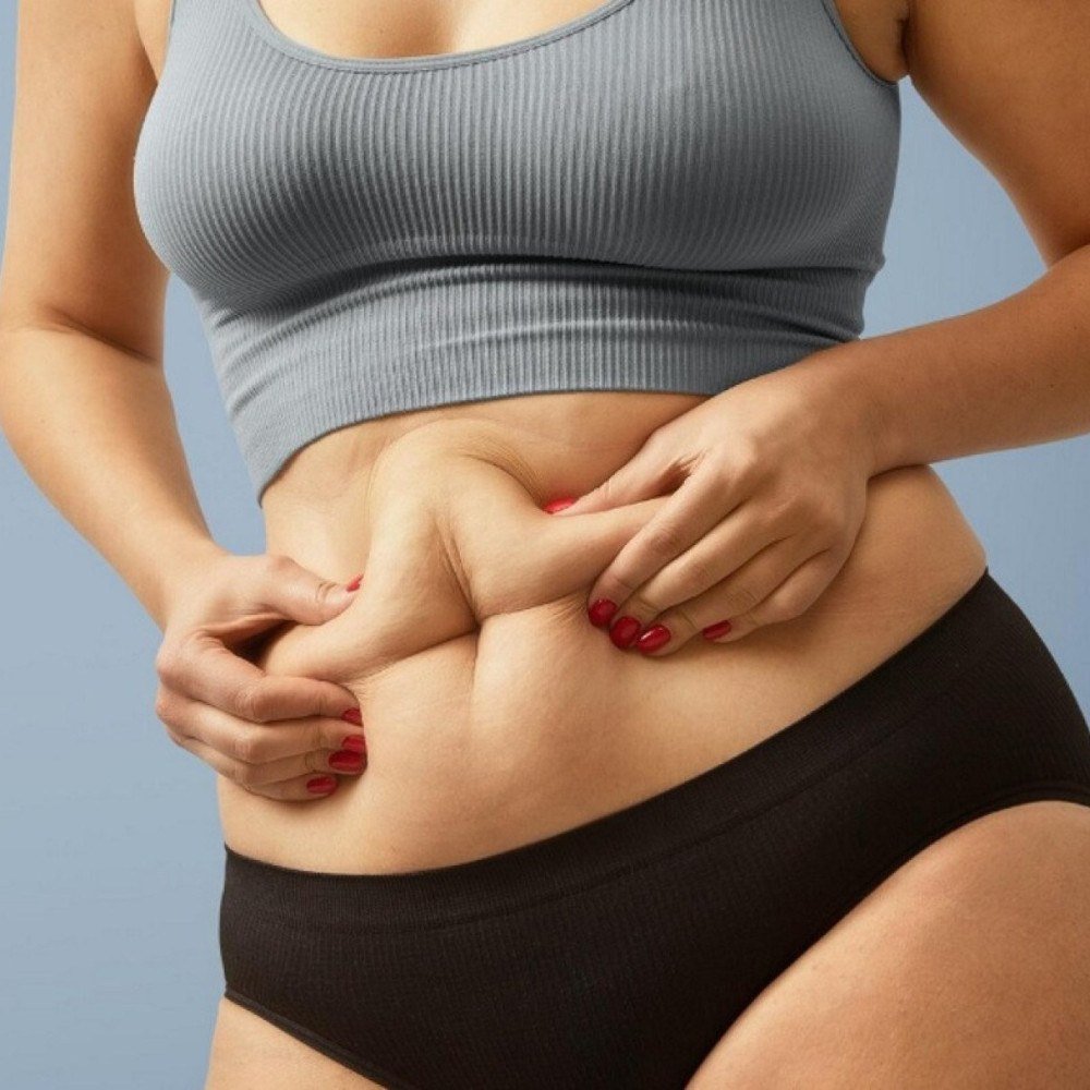 Gordura localizada: quais regiões do corpo são mais difíceis de diminuir?