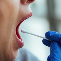 OMS recomenda testes de diagnóstico rápido para erradicar tuberculose - Drazen Zigic/FreePik