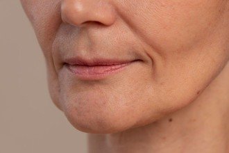Como tratar a flacidez do rosto?
