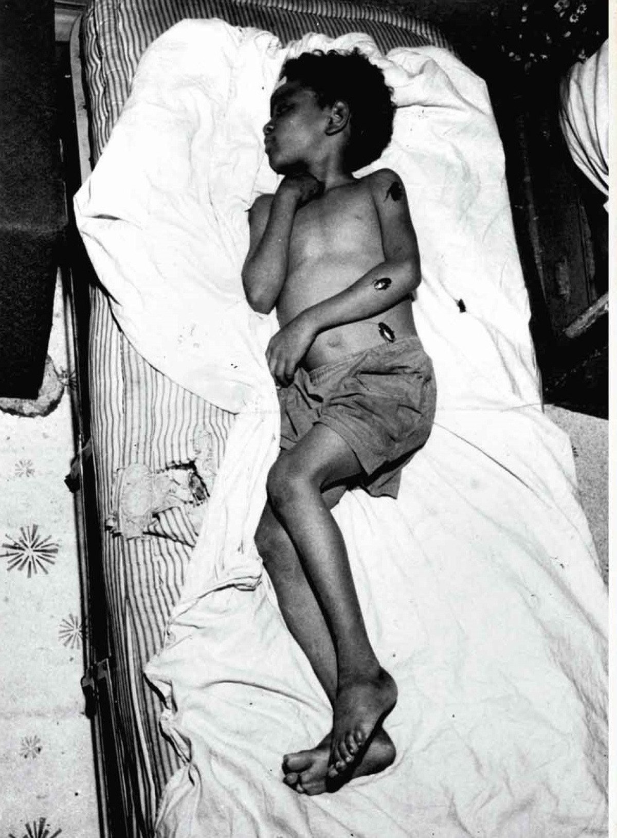 Imagem gerou v&aacute;rias acusa&ccedil;&otilde;es de manipula&ccedil;&atilde;o ao mostrar o menino cercado por baratas, levantando d&uacute;vidas sobre a veracidade do registro