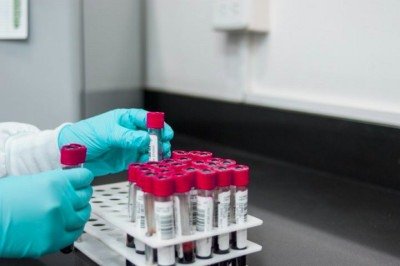 Para isso, os cientistas estão tentando reproduzir células sanguíneas e do sistema imunológico de Harrison e de outros doadores. -  (crédito: fernando zhiminaicela/Pixabay)