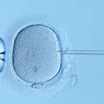 Desequilíbrio de bactérias no sêmen está ligado a mais perdas gestacionais, diz estudo - Reprodu&ccedil;&atilde;o do Youtube Canal Fertility Associates