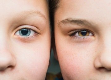 A dificuldade de olhar diretamente nos olhos de outras pessoas costuma surgir nos primeiros meses de vida -  (crédito: FreePik)