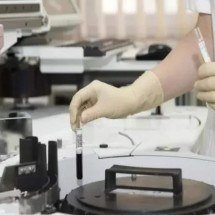 Tratamento com células CAR-T para leucemia e linfomas pode chegar ao SUS em dois anos - Pixabay