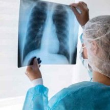 Doença antiga, ameaça atual: a persistência da tuberculose no século 21 -  Imagem Freepik