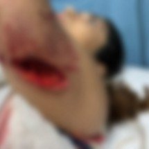 Terapeuta leva oito pontos ao tentar salvar cadela de ataque de cão em BH - Reprodução/Redes Sociais