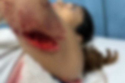 lllll -  (crédito: Reprodução/Redes Sociais)