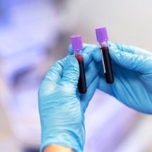 MG: farmacêutico receberá adicional máximo de insalubridade - Freepik/Reprodução