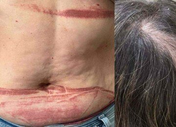 A madrasta teve os cabelos puxados e foi arrastada, enquanto o suspeito ainda tentou jogá-la do segundo andar da casa -  (crédito: Reprodução/PCMG)