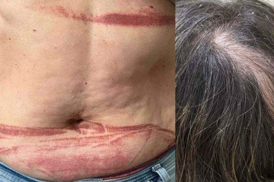 A madrasta teve os cabelos puxados e foi arrastada, enquanto o suspeito ainda tentou jogá-la do segundo andar da casa -  (crédito: Reprodução/PCMG)