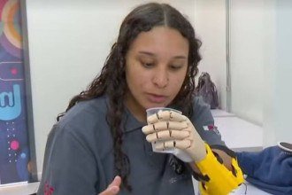 Maria Alice com a prótese de impressão 3D -  (crédito: TV Globo / reprodução)