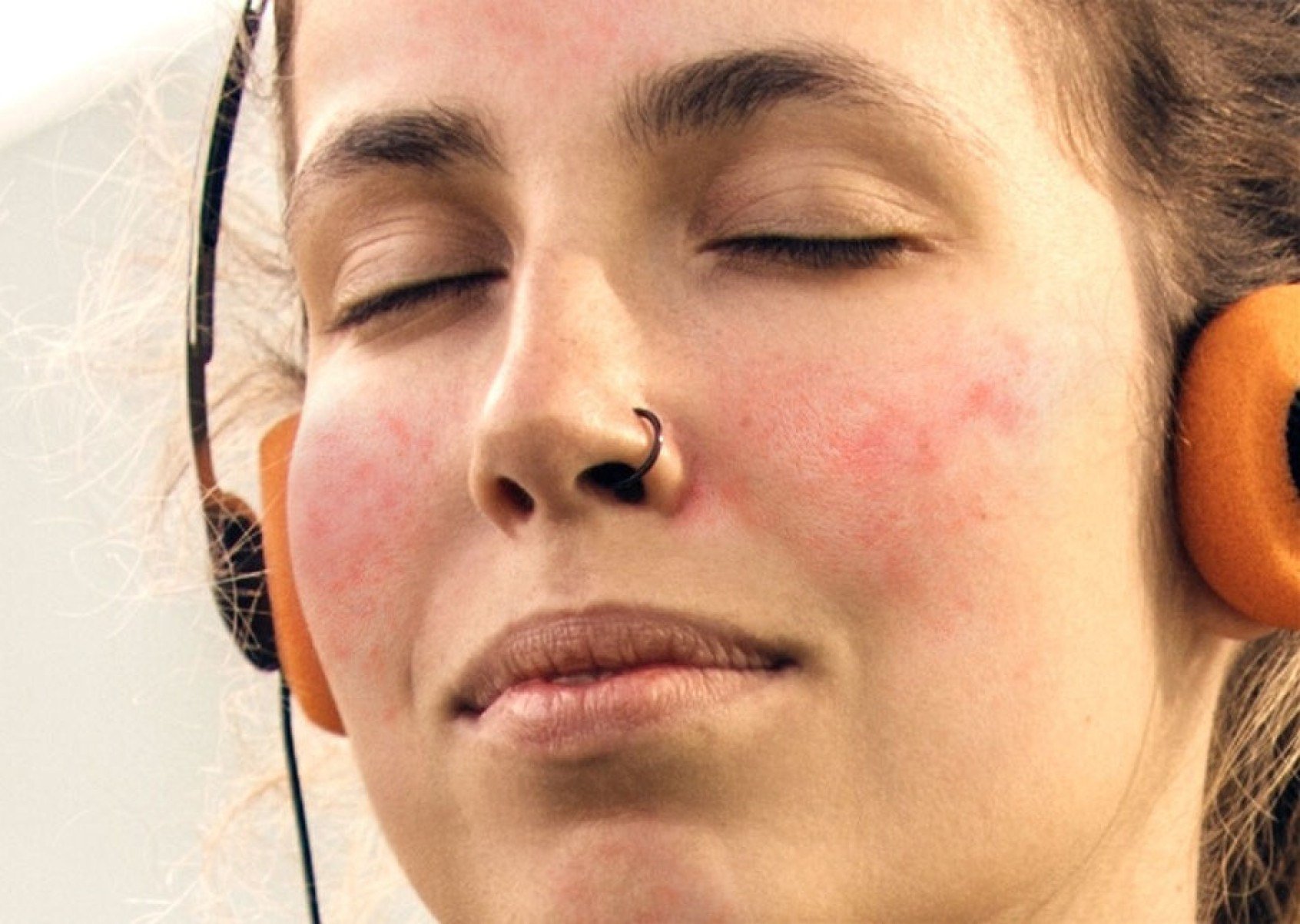 Pele sensível: especialista alerta para sinais e tratamentos - DINO