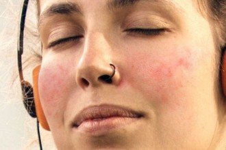 Pele sensível: os sinais que você não deve ignorar