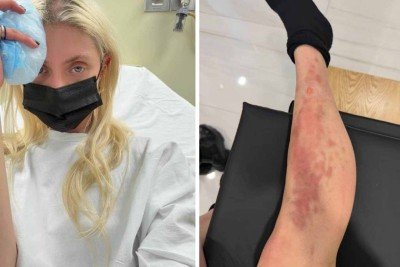 Taylor Momsen foi hospitalizada depois de ser picada por aranha -  (crédito: Redes sociais)