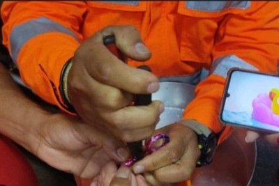 Bombeiros cortam zíper que ficou preso em dedo de criança de seis anos -  (crédito: Divulgação/CBMMG)