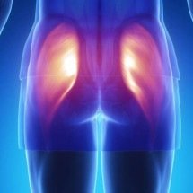 Aumento de glúteos com gordura própria: benefícios, riscos e como funciona a lipoenxertia glútea - Portal Giro 10