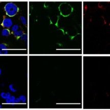 Cientistas usam ultrassom para estourar vírus da influenza A e da COVID-19  - Flávio Protásio Veras et al./Scientific Reports