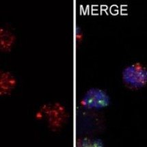 Estudo identifica proteína que protege as células de defesa - Jefferson Antônio Leite et al./Nature Communications