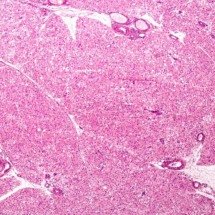 O motor oculto do corpo: a ciência por trás da gordura marrom ativada e sua relação com o gasto calórico - Portal Giro 10