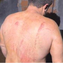 Uberlândia: Homem torturado é resgatado e escapa da morte - DivulgaÃ§Ã£o/PMMG