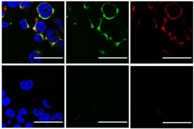 Acima, controle da experimentação; abaixo, efeito de eliminação do ultrassom contra vírus  -  (crédito: Flávio Protásio Veras et al./Scientific Reports)