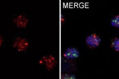 A investigação demonstrou que a proteína XPC, que atua diretamente em reparo de lesões no genoma, também desempenha um papel central no processo de diferenciação dos linfócitos  -  (crédito: Jefferson Antônio Leite et al./Nature Communications)