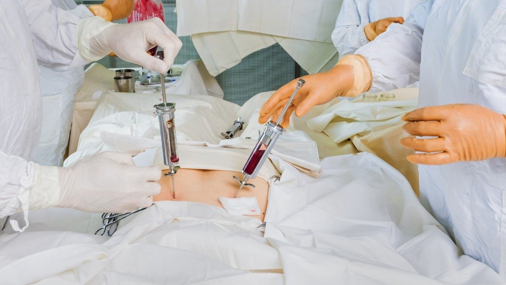 Como a doação de medula óssea pode salvar vidas; saiba como ajudar - Projeto Seja Um Her&oacute;i/ Divulga&ccedil;&atilde;o oficial