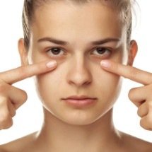 Nem tudo é sono: o que suas olheiras realmente revelam sobre genética, circulação e estrutura do seu rosto - Portal Giro 10