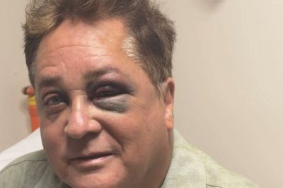 Leonardo sofreu acidente em pescaria e apareceu com olhos roxos no Instagram na esposa  -  (crédito: Instagram/ Reprodução)