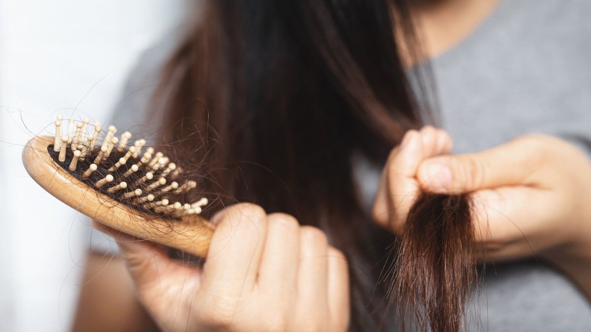 A queda de cabelo excessiva no dia a dia, como a notada na escova, pode ser um sintoma de alopecia e merece aten&ccedil;&atilde;o. -  (crédito: rattanakun)