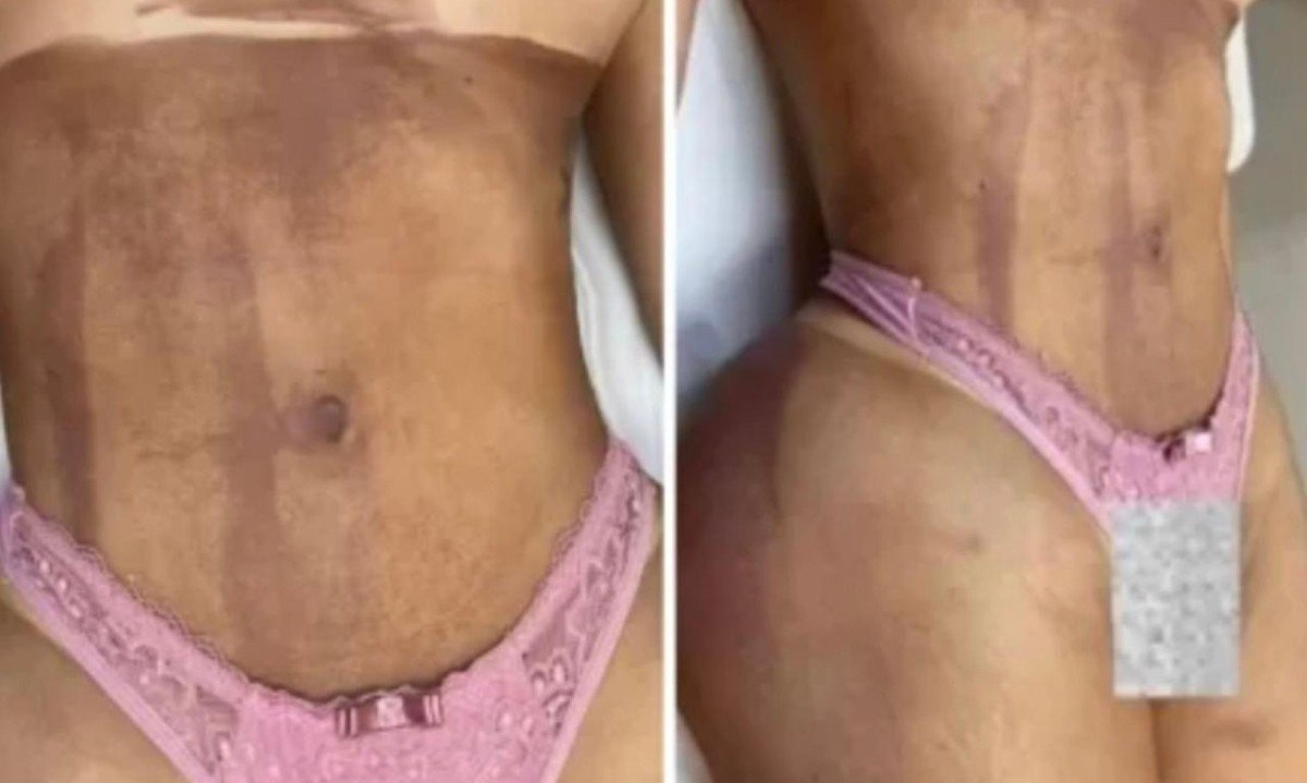 A DJ Danny Albuquerque compartilhou o retorno &agrave; carreira ap&oacute;s um hiato provocado por queimaduras severas