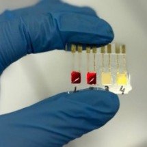 Biossensor identifica câncer de pâncreas em estágios iniciais -  Gabriella Soares