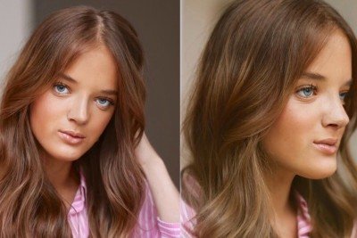 Rafaella Justus exibe o resultado de sua segunda rinoplastia, procedimento que, segundo ela, foi por 'escolha' e n&atilde;o por falta de autoestima. -  (crédito: Redes sociais)