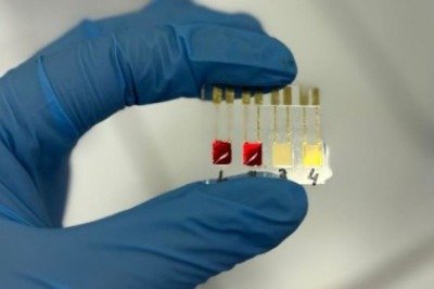 Objetivo da pesquisa é criar uma ferramenta de rastreio de baixo custo que facilite o acesso e aumente significativamente as chances de sucesso terapêutico  -  (crédito:  Gabriella Soares)