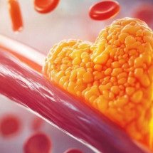 Colesterol alto pode ser genético: quando investigar - Freepik