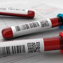 Do roxo ao cinza: saiba o porquê das cores dos tubos de exames de sangue - Divulgação