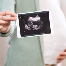 Soluços fetais: o que são esses movimentos rítmicos na barriga e por que eles indicam o desenvolvimento saudável do bebê - Portal Giro 10