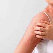 Descamação da pele após o sol: como a apoptose protege o DNA e por que puxar pelinhas pode ser perigoso à saúde cutânea - Portal Giro 10