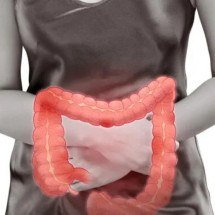 Diverticulite em alta tem sintomas solenciosos e c resce entre mulheres - depositphotos.com / Tharakorn