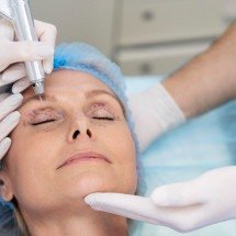 Blefaroplastia remodela pálpebras e rejuvenesce o olhar - DINO