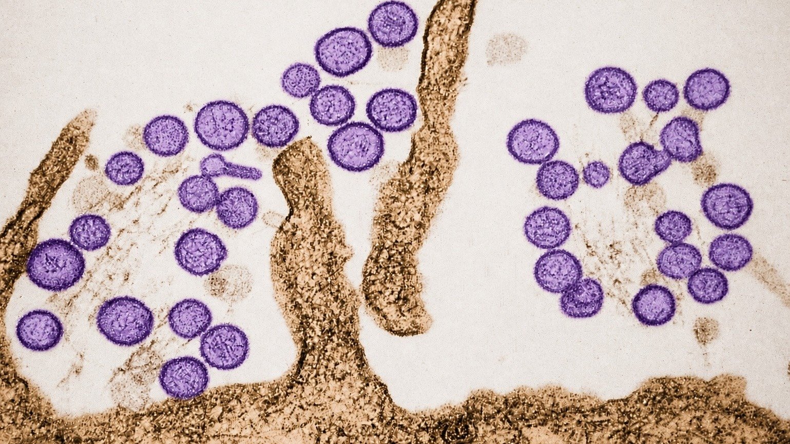 V&iacute;rus do g&ecirc;nero Hantavirus, causador da hantavirose, visto em microscopia eletr&ocirc;nica, ilustrando o agente patog&ecirc;nico. -  (crédito:  Centers for Disease Control and Prevention's Public Health Image Library (PHIL)