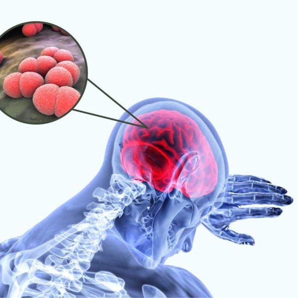 Caso fatal em MG acender alerta para evolução rápida de meningite
