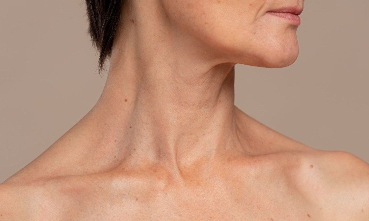Botox no pescoço: Anvisa aprova novo uso para harmonização facial - FreePik