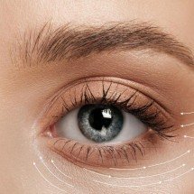 Blefaroplastia lidera ranking mundial de cirurgias - DINO