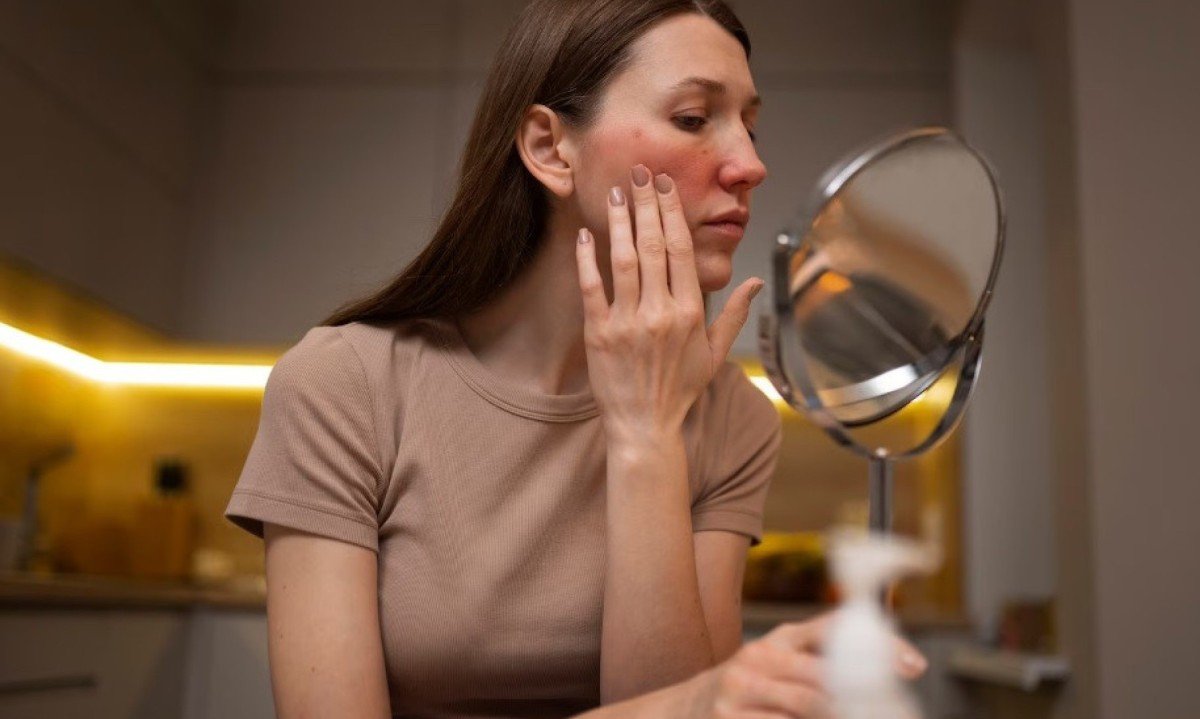 Lesões dermatológicas são conhecidas, mas não estão presentes em todos os casos - (crédito: Freepik)