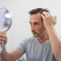 Tratamentos ampliam alternativas para calvície masculina - DINO