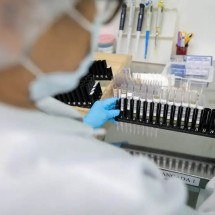 Fiocruz obtém patente para tratamento contra malária resistente - Alex Pazuello/Secom