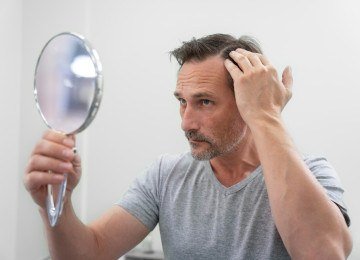 Tratamentos ampliam alternativas para calvície masculina -  (crédito: DINO)