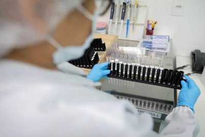 Composto mostrou ação contra formas graves e resistentes da malária -  (crédito: Alex Pazuello/Secom)